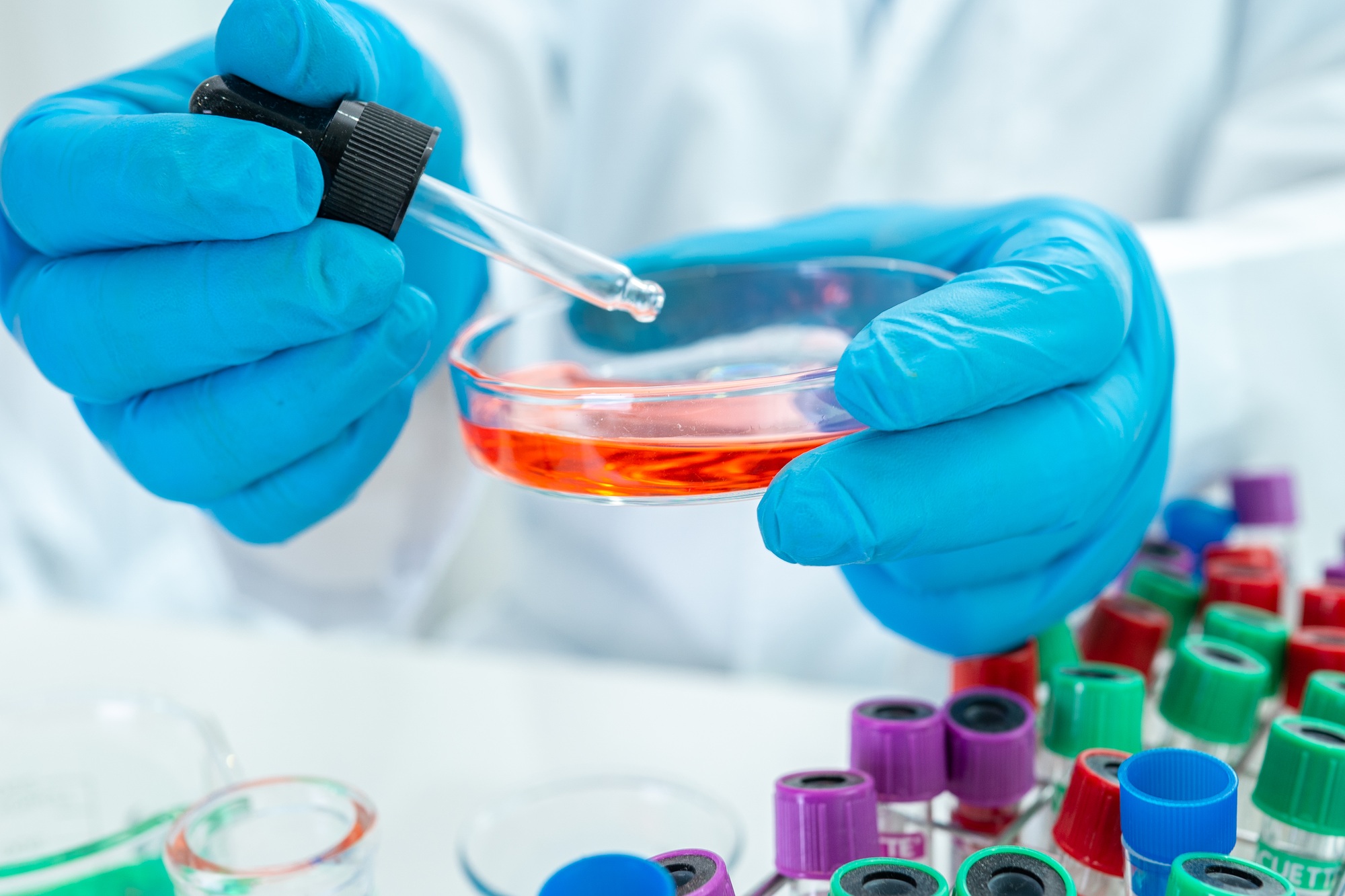 Scientist analysis micro biological sample in laboratory for doctor in the world.